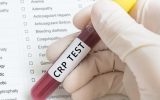 آزمایش CRP چیست و چرا تجویز می‌ شود؟